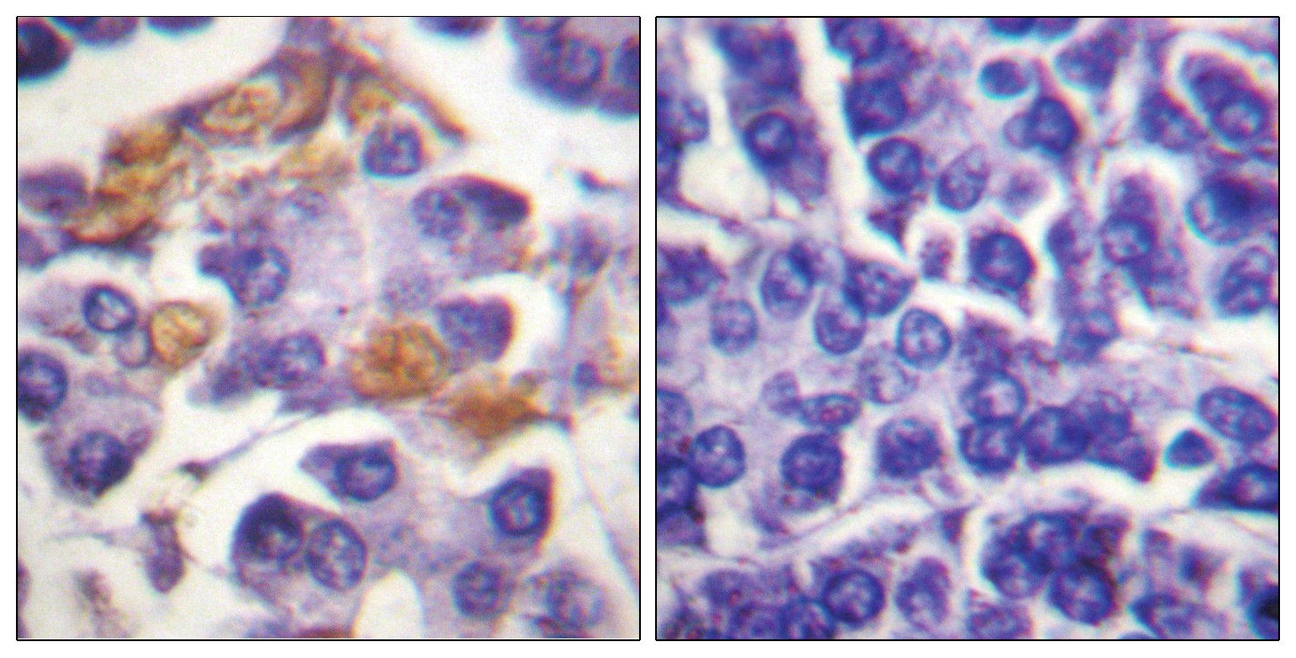 C-RAF (phospho Tyr341) Antibody