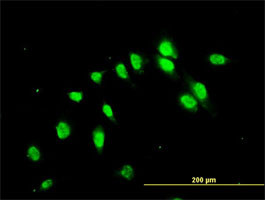 NJMU-R1 Antibody (monoclonal) (M01)