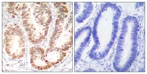 p38 MAPK (Phospho-Tyr182) antibody