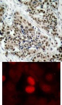 FKHR (phospho Ser256) Antibody