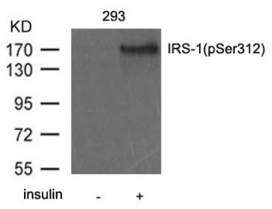IRS 1 (phospho Ser312) Antibody