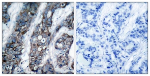 HER2 (Phospho-Tyr1248) antibody