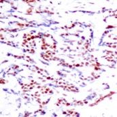 ATF2 (phospho Thr71 / 53) Antibody