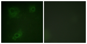 IRS-1 antibody