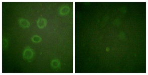 HER2 (Phospho-Thr686) antibody