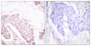 Akt (Phospho-Ser124) antibody