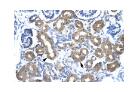 CBX4 antibody