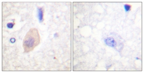CDC25B (Phospho-Ser353) antibody