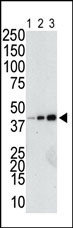 GST Tag Antibody