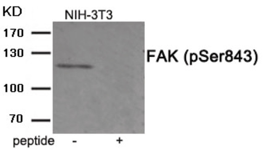 FAK (phospho Ser843) Antibody