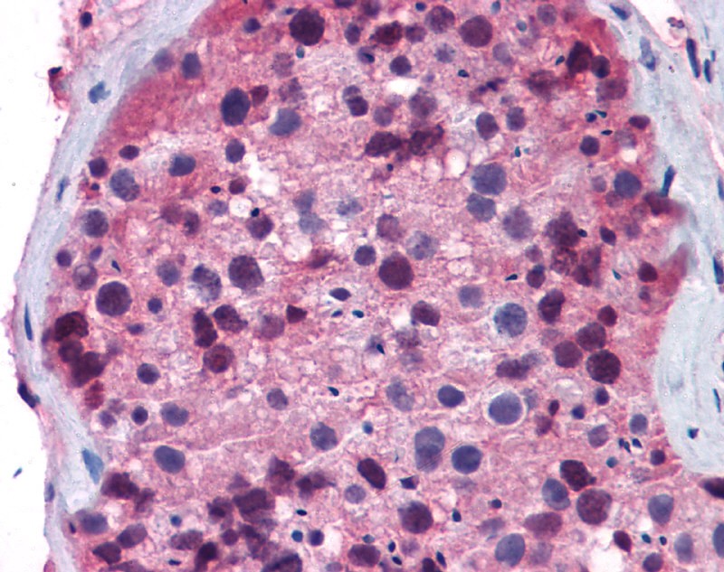 FOXO1 antibody - middle region