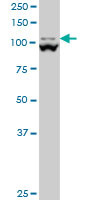 MTHFD1L Antibody (monoclonal) (M01)