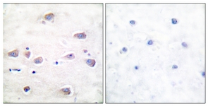 NMDAR1 (Phospho-Ser897) antibody