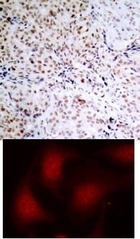 Rb (phospho Ser795) Antibody