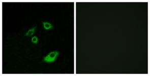 BCL-2 (Phospho-Thr56) antibody