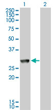 MGC40579 Antibody (monoclonal) (M11)