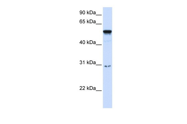 AIRE antibody - middle region