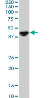 NODAL Antibody (monoclonal) (M05)