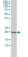 MPHOSPH6 Antibody (monoclonal) (M01)