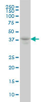 MEF2B Antibody (monoclonal) (M10)