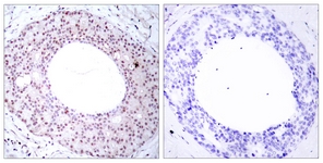 NF-kappaB p65 (Phospho-Thr254) antibody