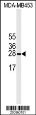 MIPEP Antibody (Ascites)