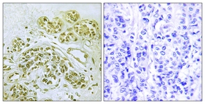 IkappaB-alpha (Phospho-Tyr42) antibody