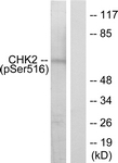 Chk2 (Phospho-Ser516) antibody