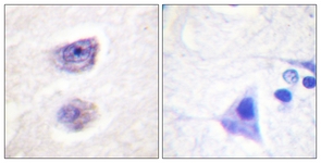 Tyrosine Hydroxylase (Phospho-Ser8) antibody