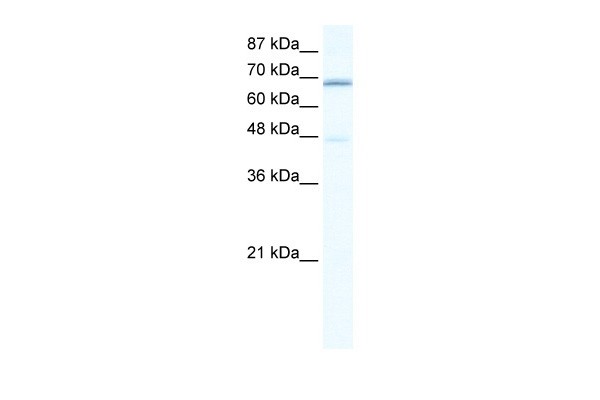 CACNB2 antibody - C-terminal region
