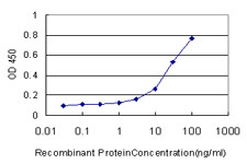 MACF1 Antibody (monoclonal) (M01)