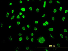 MCM3 Antibody (monoclonal) (M01)