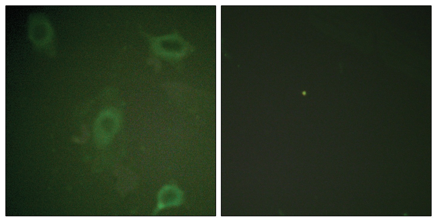 Amyloid beta A4 (phospho Thr743/668) Antibody