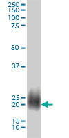 NBL1 Antibody (monoclonal) (M01)