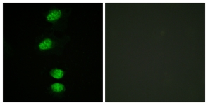 Androgen Receptor (Phospho-Ser94) antibody