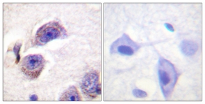 FAK (Phospho-Tyr407) antibody