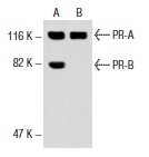 PR Antibody (AB-52)