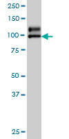 NDST1 Antibody (monoclonal) (M01)