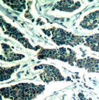 AKT1 / AKT2 / AKT3 Antibody