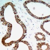 14 3 3 zeta Antibody