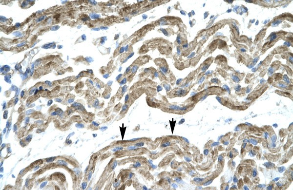 C13ORF8 antibody