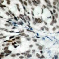 Rb Antibody