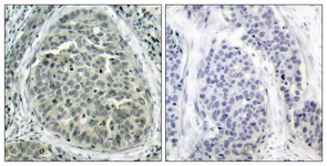 Catenin-beta (Phospho-Ser37) antibody
