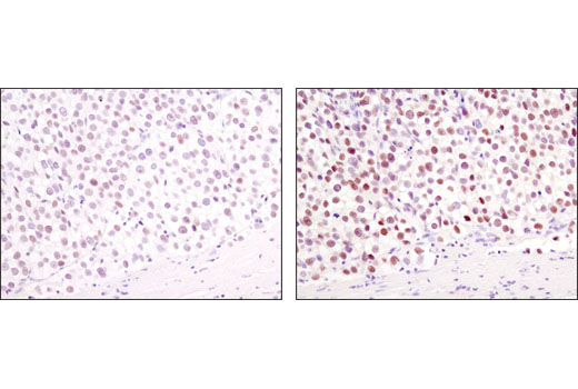 SignalStain ® Boost IHC Detection Reagent (HRP, Mouse)