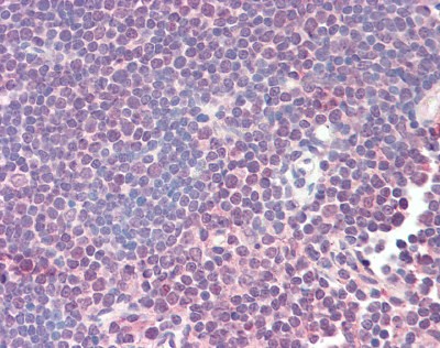ZAP70 Antibody