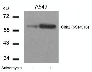 Chk2 (phospho Ser516) Antibody