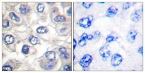 BAD (Cleaved-Asp71) antibody