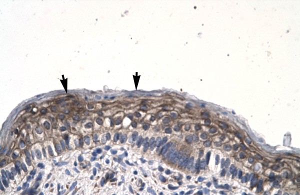 JMJD8 antibody - middle region