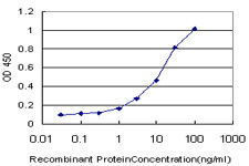 MTHFR Antibody (monoclonal) (M06)