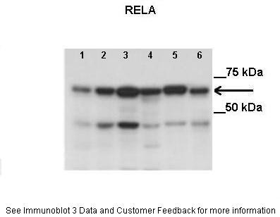 RELA antibody - middle region